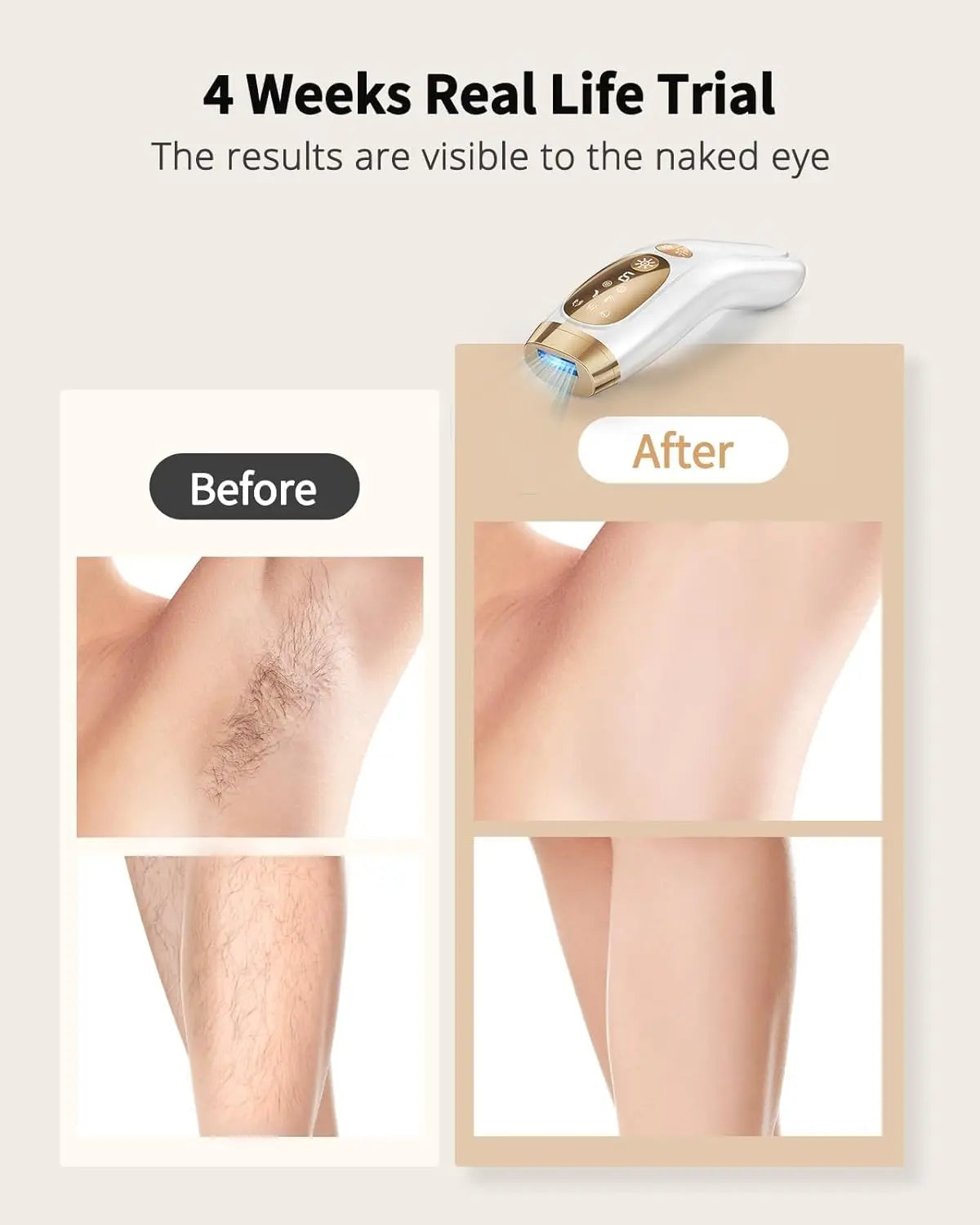 JOOYEE IPL Hair Removal Painless Full Body Solution