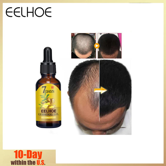 Eelhoe Ginger Hair Growth Liquid For Strengthening Antithinning Scalp